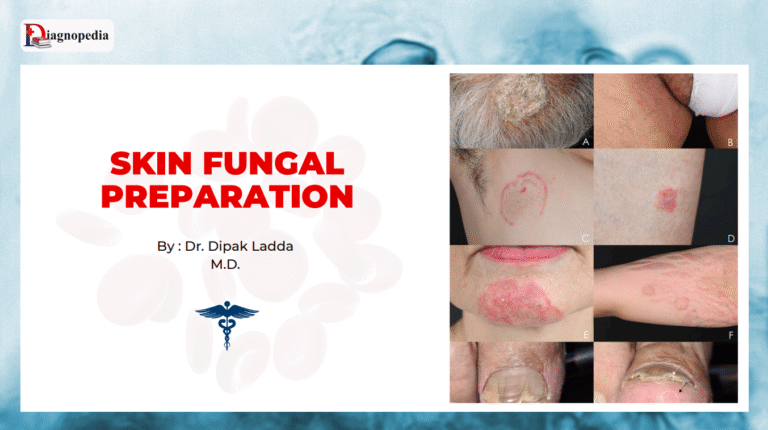 Skin Fungal Preparation Test
