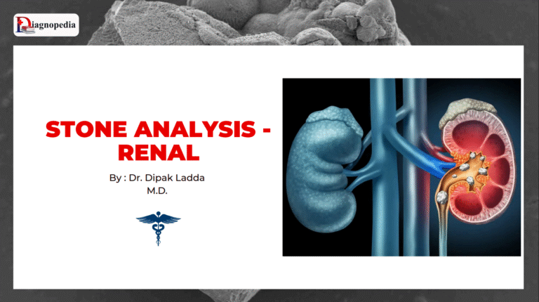 Renal stone analysis