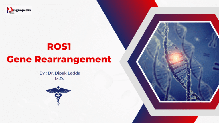 ROS1 Gene Rearrangement