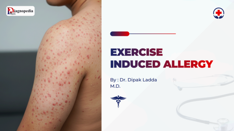 Exercise-Induced Allergy