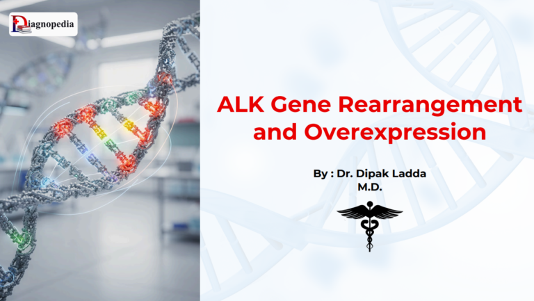 ALK Rearrangement and Overexpression