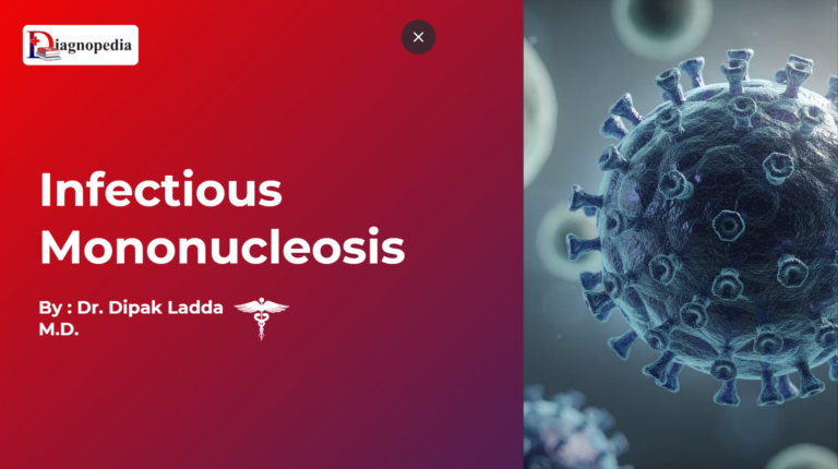Infectious Mononucleosis