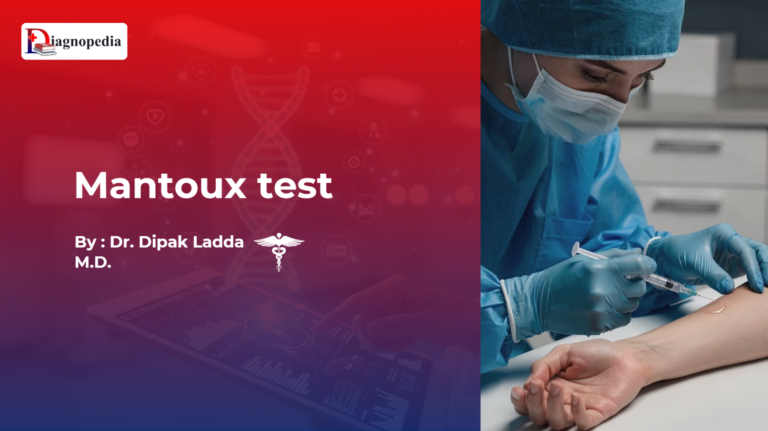 Mantoux test