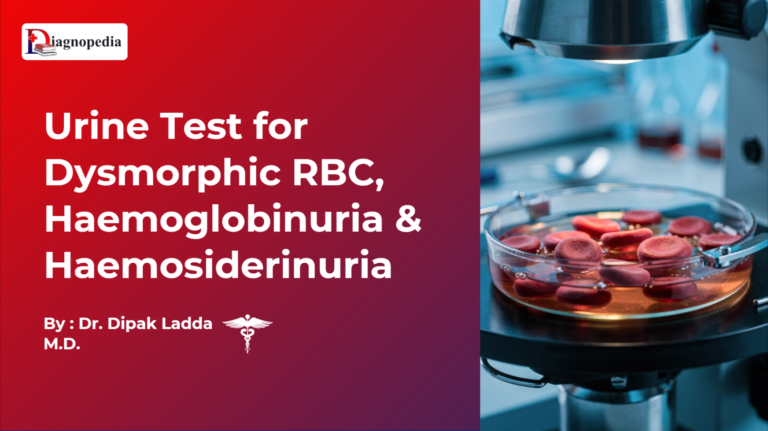 Urine Test for Dysmorphic RBC, Haemoglobinuria & Haemosiderinuria