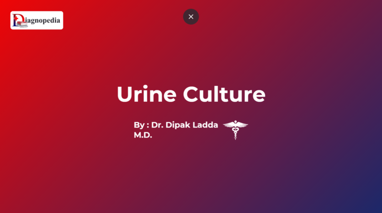 Urine culture
