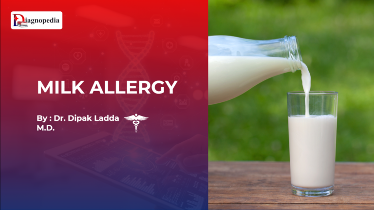 Milk Allergy