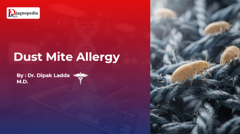 Dust Mite Allergy